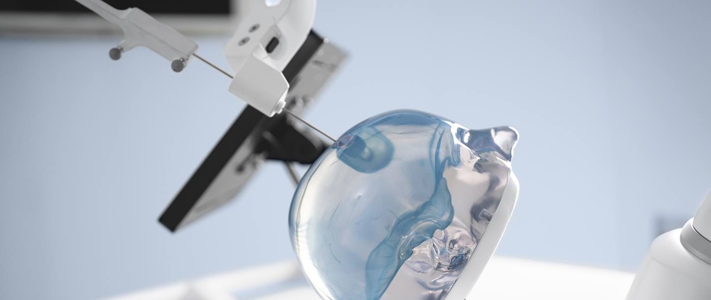 Medical Robotics NDI Cell Headerfoto